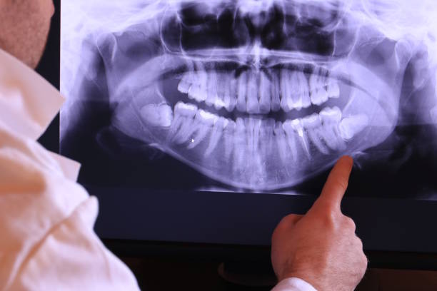 Best Emergency Dental Care for Trauma or Injury in Glenville, CT